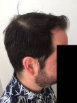 12-months-right-profile-less.jpg