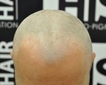 1. before treatment.jpg