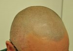 5. after 2 session sides.jpg
