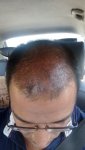 IMG20170904121516.jpg
