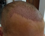 16072017 Right Side.JPG