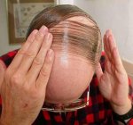 Combover.jpg