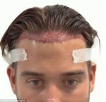 48842FFE00000578-5309005-Hair_we_go_James_new_look_comes_after_he_revealed_he_had_undergo-a-1_...jpg