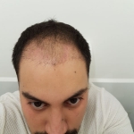 20180224_195410.jpg