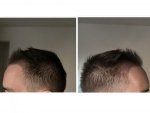 collage hairy 10.jpg