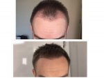 collage comparison.jpg