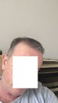 Post Surgery 5.5 months 1.jpg