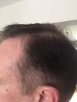 Post Surgery 7 months 2.jpg