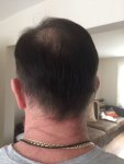 Post Surgery 7 months 3.jpg