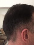 Post Surgery 7 months 4.jpg