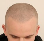 tobias after.jpg