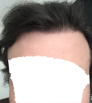 vKCaRNB.png