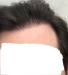 zB6h25u.png