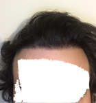 52ZuB1m.png