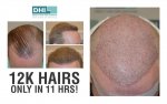 12k hair in a day new.jpg