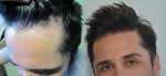 hair.jpg
