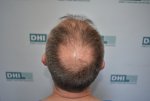 BEFORE (7).JPG
