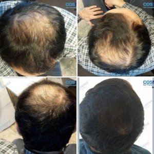Dr Levent Acar