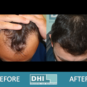 3316_120837_020000001.png