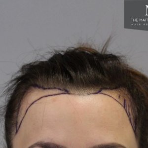 The Maitland clinic Pre op.JPG