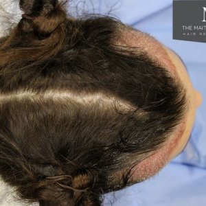 The Maitland clinic Imm post op.JPG