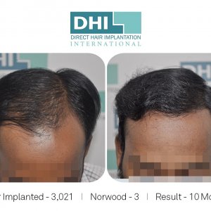 DHI Success Story 3