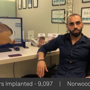 Pardeep Paul Shares His Feedback Regarding DHI Technique- Global Leader in Hair Transplant