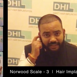 DHI Medical Group- Global Leader in Hair Transplant and Restoration | Patient Testimonial-Must Watch