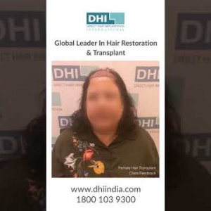 Female Hair Transplant at DHI -Leader in Hair Transplant- See Amazing Hair Transplant Result