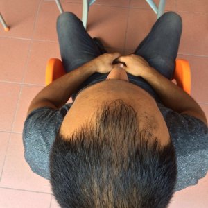 FUE 3250 GREFT BY DR. BİCER