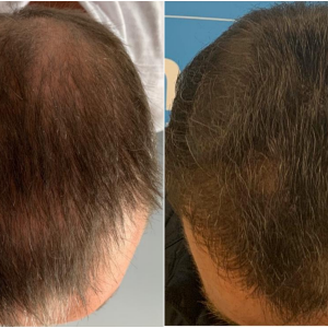 4. before-after-top. ben-thornley.png