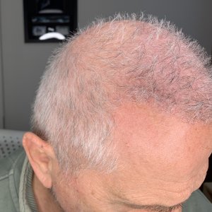 Front Side_Right Tilt Down.jpg