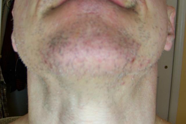 209_281125_590000002.jpg