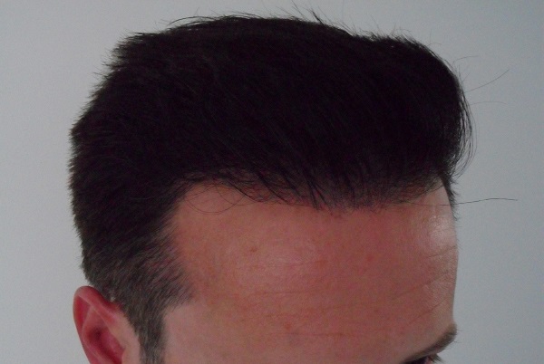 3764_031757_150000000.jpg