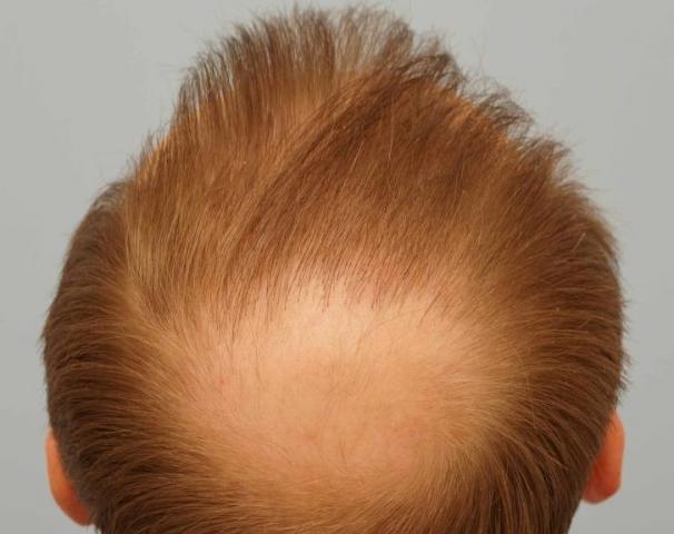 3851_021045_310000002.jpg