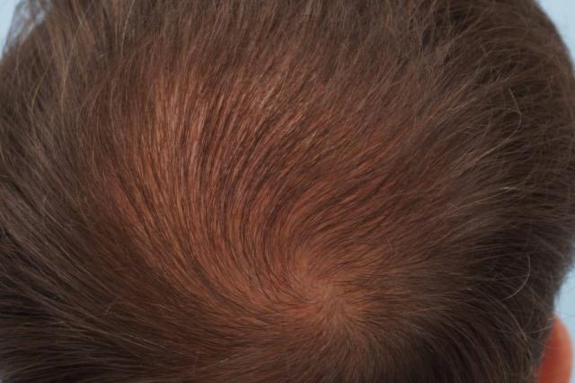 3851_130949_100000000.jpg