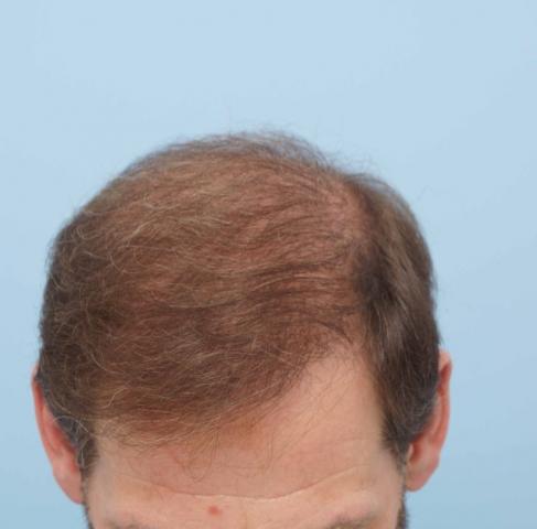 3851_171342_270000003.jpg