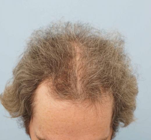 3851_180951_520000001.jpg