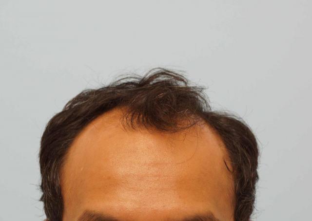 3851_231101_220000000.jpg