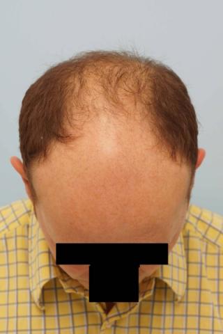 3851_241450_260000001.jpg
