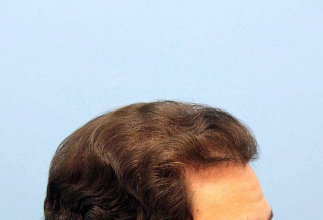3851_251018_340000000.jpg