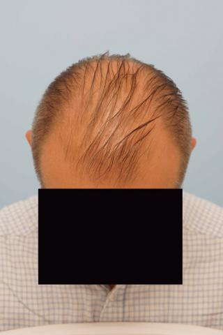 3851_281556_050000001.jpg