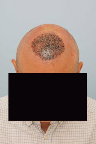 3851_281557_470000001.jpg