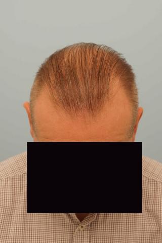 3851_281618_210000000.jpg