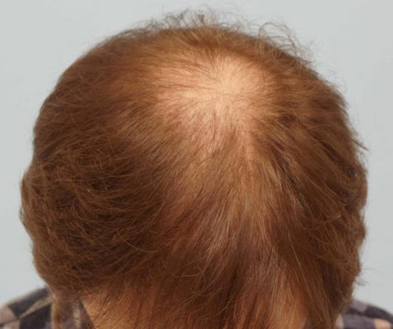 3851_291133_550000001.jpg