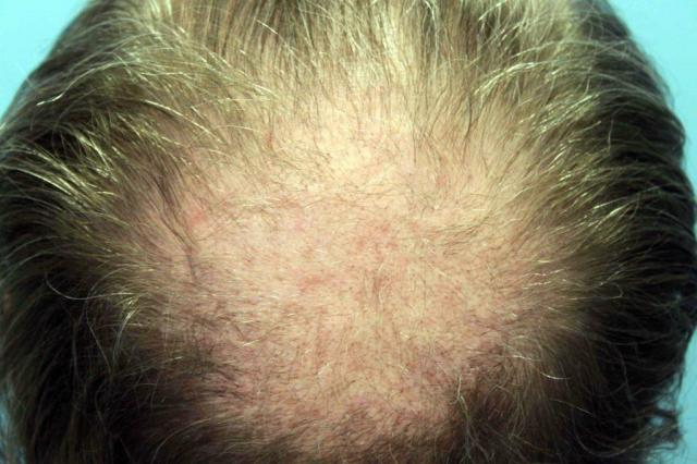3851_300959_050000002.jpg