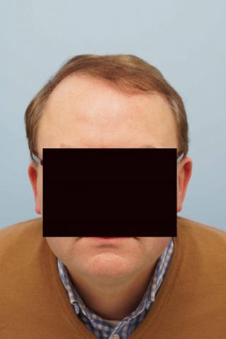 3851_301000_070000001.jpg