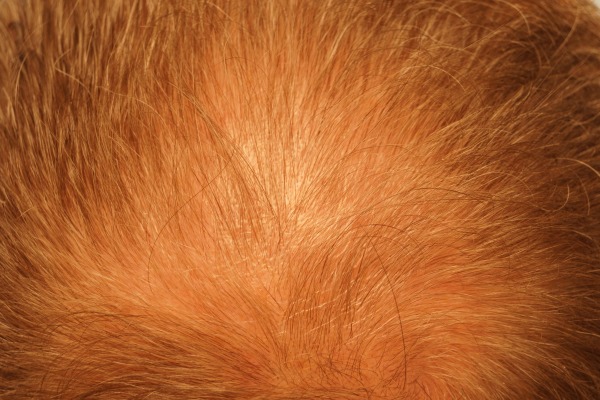 3851_301059_250000003.jpg