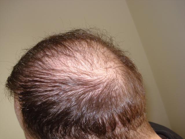 623_160418_170000003.jpg
