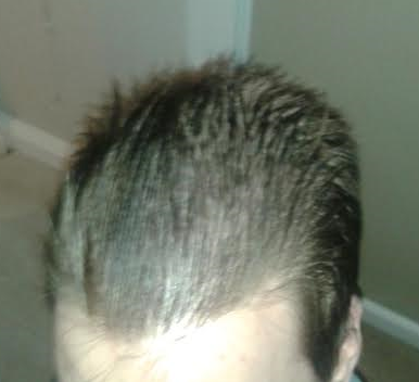6278_222203_120000000.png